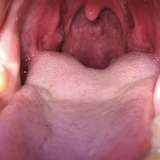 n3edymouth from onlyfans